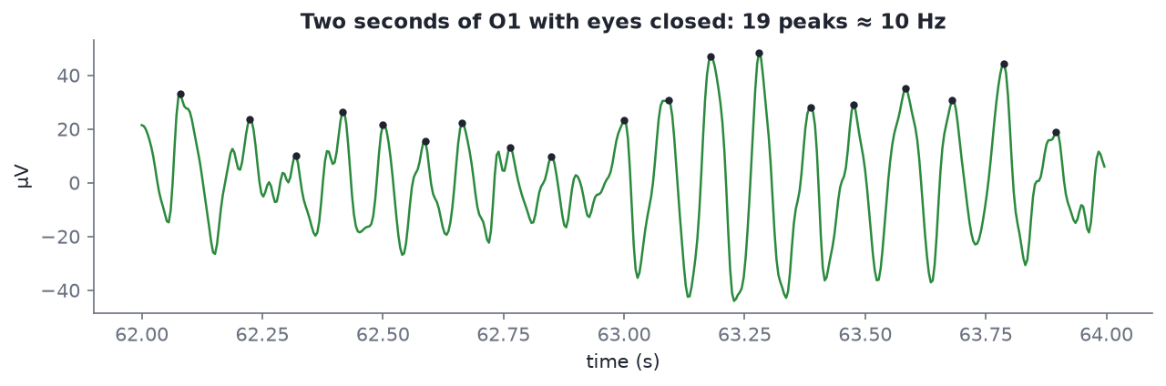 Two seconds of O1 with eyes closed; 19 peaks, about 10 Hz