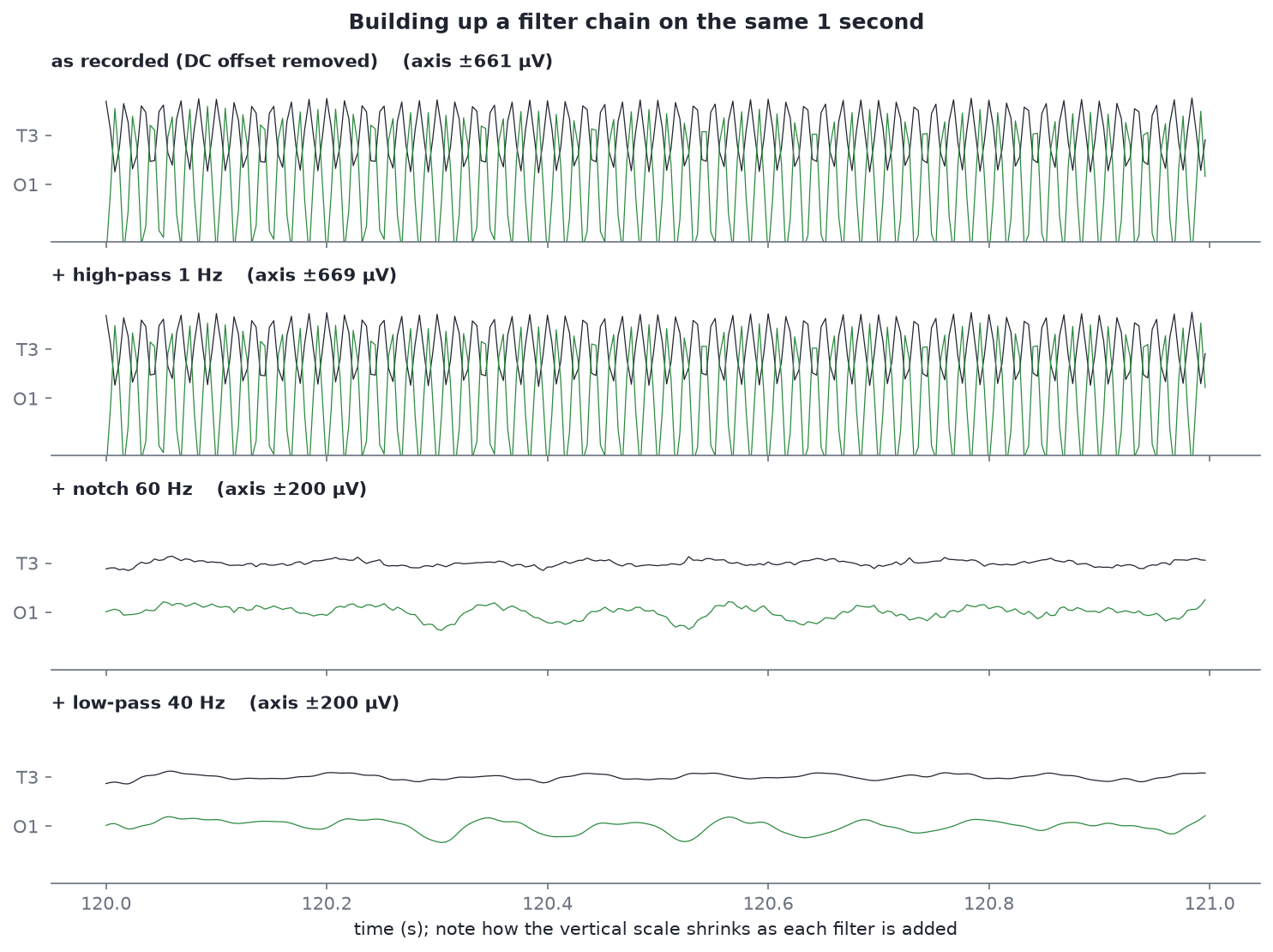 Four rows showing T3 and O1 as a filter chain is built up: raw, high-pass 1 Hz, notch 60 Hz, low-pass 40 Hz