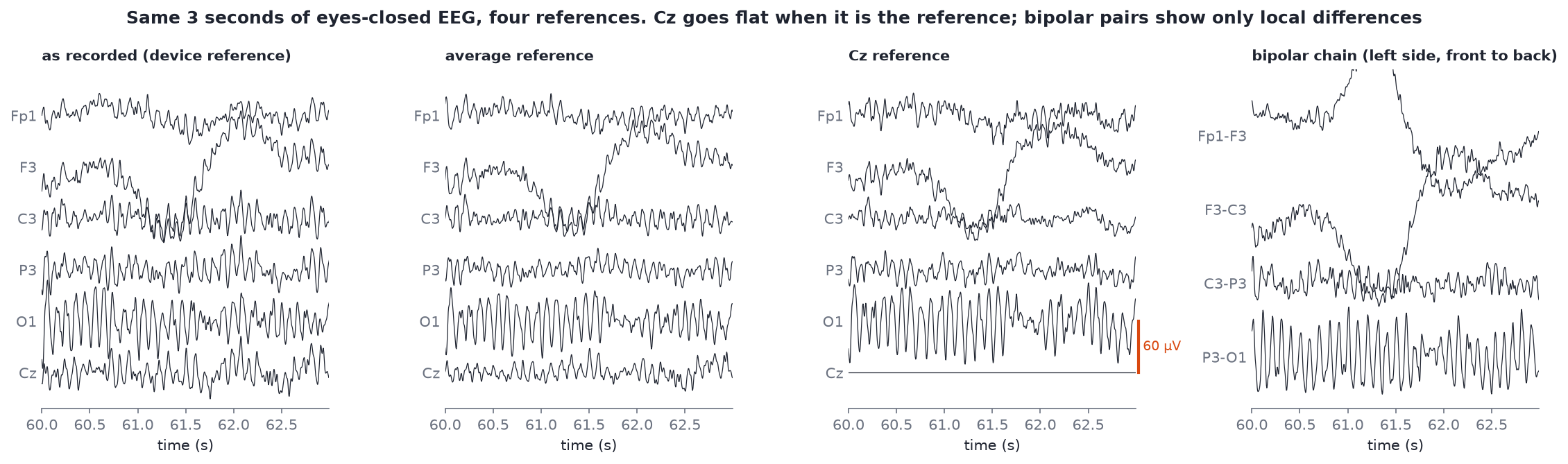 The same three seconds of eyes-closed EEG under the device reference, average reference, Cz reference and a bipolar chain